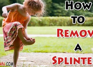 How to Remove a Splinter