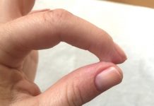 How to Get Super Glue off Hands