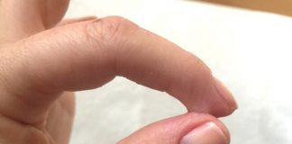 How to Get Super Glue off Hands