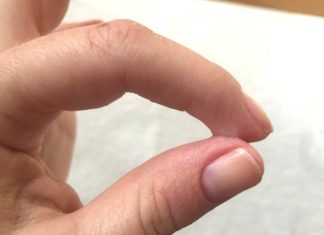 How to Get Super Glue off Hands