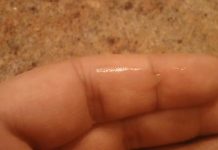 How to Get Super Glue off Your Fingers